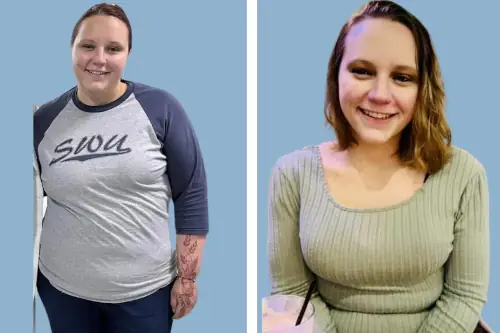 Testimonial image of a smiling patient sharing her life-changing bariatric surgery experience in India through IndiCure.